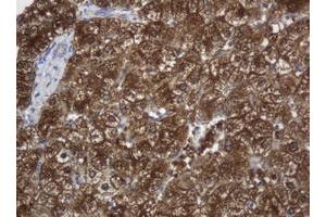 Image no. 3 for anti-Mast/stem Cell Growth Factor Receptor (KIT) (AA 546-976) antibody (ABIN1491585)