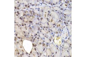 Immunohistochemistry of paraffin-embedded rat pancreas using IRF6 antibody at dilution of 1:200 (400x lens).
