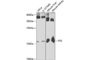Western blot analysis of extracts of various cell lines, using PTS antibody (ABIN6129844, ABIN6146483, ABIN6146485 and ABIN6221911) at 1:1000 dilution. (PTS Antikörper  (AA 1-145))