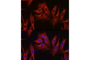 Immunofluorescence analysis of NIH-3T3 cells using HMGCR Rabbit pAb (ABIN3022293, ABIN3022294, ABIN3022295, ABIN1513022 and ABIN6218714) at dilution of 1:100 (40x lens). (HMGCR Antikörper  (AA 629-888))