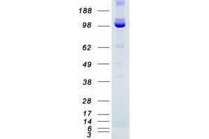 Western Blotting (WB) image for Budding Uninhibited By Benzimidazoles 1 Homolog beta (Yeast) (BUB1B) protein (Myc-DYKDDDDK Tag) (ABIN2715361)