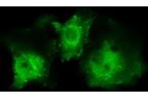 Image no. 1 for anti-Pleckstrin (PLEK) antibody (ABIN1500272) (Pleckstrin Antikörper)