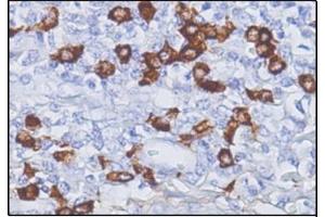 Immunohistochemistry (IHC) image for Mouse anti-Human IgG4 antibody (ABIN952860) (Maus anti-Human IgG4 Antikörper)