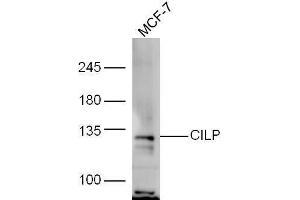 MCF-7 lysate probed with Rabbit Anti-CILP Polyclonal Antibody, Unconjugated  at 1:5000 for 90min at 37˚C. (CILP Antikörper  (AA 1051-1184))