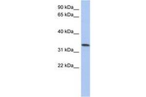 Image no. 1 for anti-Chromosome 10 Open Reading Frame 96 (C10orf96) (AA 143-192) antibody (ABIN6743913) (C10ORF96 Antikörper  (AA 143-192))