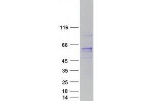 Western Blotting (WB) image for Regulator of Chromosome Condensation (RCC1) and BTB (POZ) Domain Containing Protein 1 (RCBTB1) protein (Myc-DYKDDDDK Tag) (ABIN2730650)