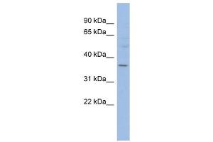 HMGCLL1 antibody used at 1 ug/ml to detect target protein. (HMGCLL1 Antikörper  (N-Term))