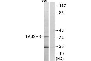Western blot analysis of extracts from COLO cells, using TAS2R8 antibody. (TAS2R8 Antikörper  (Internal Region))