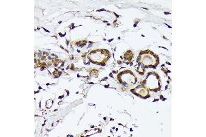 Immunohistochemistry of paraffin-embedded human breast using PSMD14 Rabbit mAb (ABIN7269588) at dilution of 1:100 (40x lens). (PSMD14 Antikörper)