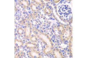 Immunohistochemistry (Paraffin-embedded Sections) (IHC (p)) image for anti-Adenylate Kinase 4 (AK4) (AA 1-223) antibody (ABIN3022790)