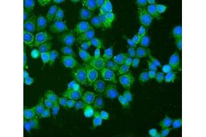anti-BCL2-Antagonist/killer 1 (BAK1) (AA 22-211) antibody