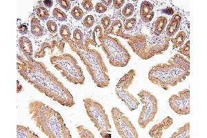 IHC analysis of CDK5 using anti-CDK5 antibody (ABIN6719393). (CDK5 Antikörper  (AA 1-226))