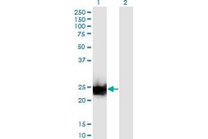 Western Blot analysis of LGALS3 expression in transfected 293T cell line by LGALS3 monoclonal antibody (M03), clone 3G8.