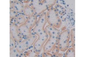 Used in DAB staining on fromalin fixed paraffin- embedded kidney tissue (RAB1A Antikörper  (AA 2-205))