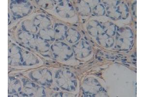 Immunohistochemistry (IHC) image for anti-ATP-Binding Cassette, Sub-Family A (ABC1), Member 1 (ABCA1) (AA 1404-1663) antibody (ABIN7433312)