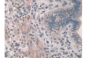 DAB staining on IHC-P; Samples: Mouse Uterus Tissue (PDE12 Antikörper  (AA 290-602))