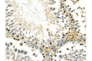 ABIN6260199 and ABIN6266752 at 1/100 staining Rat testis tissue by IHC-P. (DMC1 Antikörper  (Internal Region))