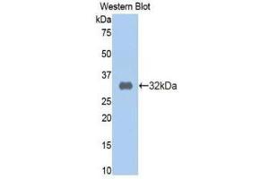 Western Blotting (WB) image for anti-alpha-2-Macroglobulin (A2M) (AA 616-856) antibody (ABIN1077780) (alpha 2 Macroglobulin Antikörper  (AA 616-856))
