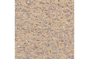 IHC analysis of RBMS1 using anti-RBMS1 antibody (ABIN7601195).