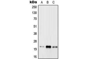 Western blot analysis of RAB31 expression in MCF7 (A), Raw264. (RAB31 Antikörper  (Center))