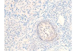 ABIN6267244 at 1/100 staining rat ovarian tissue sections by IHC-P.