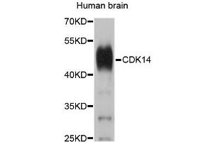 Western blot analysis of extracts of human brain, using CDK14 antibody (ABIN5995451). (CDK14 Antikörper)