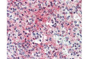 Anti-CCL5 / RANTES antibody IHC of human spleen. (CCL5 Antikörper)