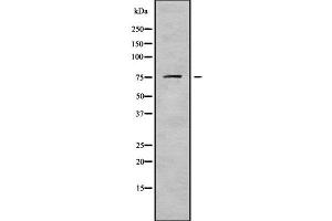 Western blot analysis of DDX18 using HuvEc whole cell lysates (DDX18 Antikörper  (N-Term))