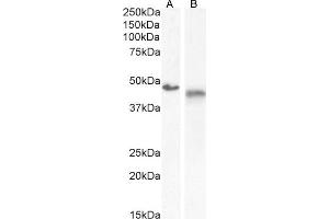 (ABIN570867) (0. (IL1R2 Antikörper  (Internal Region))