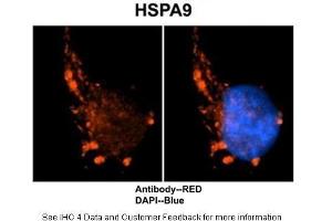 Immunohistochemistry (IHC) image for anti-Heat Shock 70kDa Protein 9 (Mortalin) (HSPA9) (C-Term) antibody (ABIN2779292)