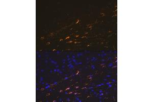 Immunofluorescence analysis of mouse brain cells using GFAP Rabbit pAb (ABIN3020750, ABIN3020751, ABIN3020752, ABIN1512943 and ABIN6213705) at dilution of 1:100 (40x lens). (GFAP Antikörper  (C-Term))