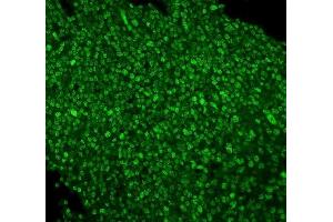 IF analysis of PTBP1 using anti-PTBP1 antibody (ABIN7599450). (PTBP1 Antikörper  (AA 1-504))