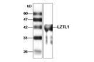 Image no. 1 for anti-Leucine Zipper Transcription Factor-Like 1 (LZTFL1) antibody (ABIN791460) (LZTFL1 Antikörper)