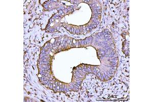 IHC analysis of Alpha Actinin 4 using anti-Alpha Actinin 4 antibody (ABIN4886421). (alpha Actinin 4 Antikörper  (AA 561-661))