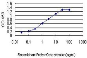 Detection limit for recombinant GST tagged MCC is approximately 0. (MCC Antikörper  (AA 31-130))