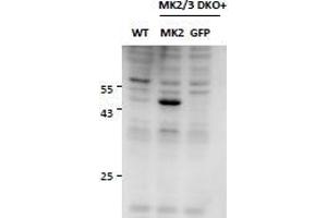 Western Blotting (WB) image for anti-Mitogen-Activated Protein Kinase-Activated Protein Kinase 2 (MAPKAPK2) antibody (ABIN5903087) (MAPKAP Kinase 2 Antikörper)