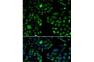 Immunofluorescence analysis of U2OS cells using EPC1 Polyclonal Antibody (EPC1 Antikörper)