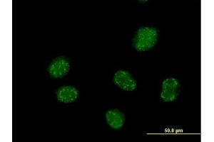 Immunofluorescence of purified MaxPab antibody to ELAC1 on HeLa cell. (ELAC1 Antikörper  (AA 1-363))