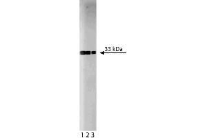 Western Blotting (WB) image for anti-Cyclin-Dependent Kinase 2 (CDK2) (AA 109-298) antibody (ABIN967777)