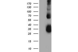 Western Blotting (WB) image for anti-Metalloproteinase Inhibitor 2 (TIMP2) antibody (ABIN1501396) (TIMP2 Antikörper)