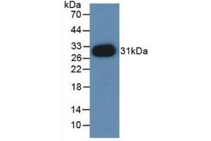 Detection of Recombinant PVRL2, Mouse using Polyclonal Antibody to Nectin 2 (NECTIN2) (PVRL2 Antikörper  (AA 83-291))