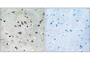 Immunohistochemistry analysis of paraffin-embedded human brain tissue, using BTF3L4 Antibody. (BTF3L4 Antikörper  (AA 94-143))