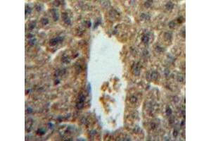 Used in DAB staining on fromalin fixed paraffin- embedded liver tissue (IL-5 Antikörper  (AA 20-134))