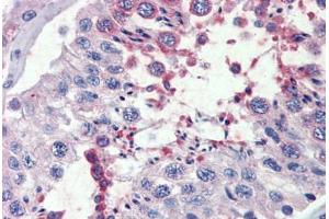 Testis, Human: Formalin-Fixed, Paraffin-Embedded (FFPE)