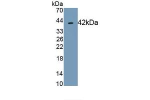 Detection of Recombinant TSPAN30, Human using Monoclonal Antibody to Tetraspanin 30Cluster of Differentiation 63 (CD63) (CD63 Antikörper  (AA 103-203))