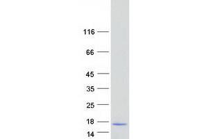 Western Blotting (WB) image for DnaJ (Hsp40) Homolog, Subfamily C, Member 12 (DNAJC12) (Transcript Variant 2) protein (Myc-DYKDDDDK Tag) (ABIN2719599)