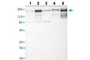 Western blot analysis of Lane 1: RT-4 cell line, Lane 2: U-251MG sp cell line, Lane 3: A-431 cell line, Lane 4: human liver tissue, and Lane 5: human tonsil tissue with LAMC1 polyclonal antibody . (Laminin gamma 1 Antikörper  (AA 1442-1552))