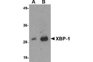 Western Blotting (WB) image for anti-X-Box Binding Protein 1 (XBP1) (AA 2-160) antibody (ABIN492538)