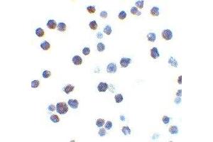 Immunohistochemistry (IHC) image for anti-BCL2-Antagonist/killer 1 (BAK1) (N-Term) antibody (ABIN2477580) (BAK1 Antikörper  (N-Term))