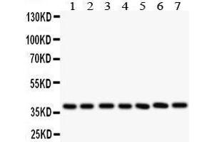 Anti-LIF antibody, Western blotting All lanes: Anti LIF  at 0. (LIF Antikörper  (C-Term))
